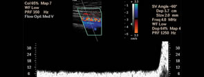 Arterial Studies